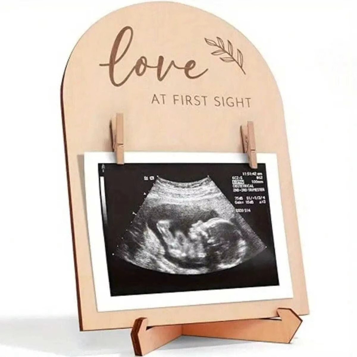1PC Cute Wooden Ultrasound Photo Frame – Pregnancy Announcement Sonogram Picture Frame – Baby Ultrasound Keepsake Decor for Nursery, Daycare & Baby Shower Gift