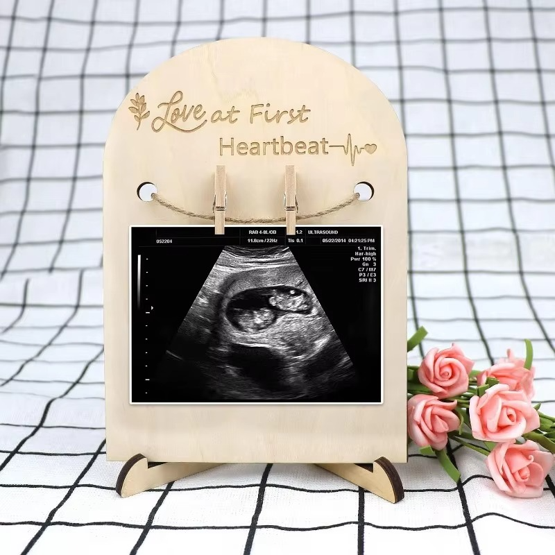 Baby Ultrasound Photo Frame – Sonogram Picture Frame Pregnancy Keepsake – Baby Announcement Gift for Couples, New Moms & Dads – Nursery Memory Decor