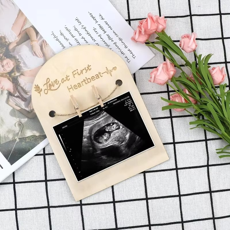 Baby Ultrasound Photo Frame – Sonogram Picture Frame Pregnancy Keepsake – Baby Announcement Gift for Couples, New Moms & Dads – Nursery Memory Decor