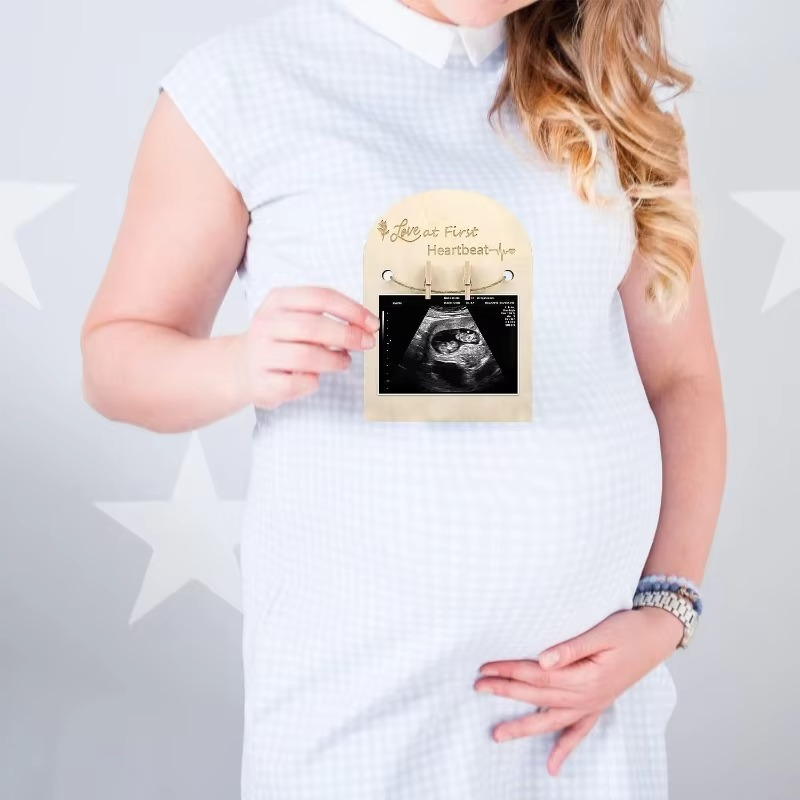 Baby Ultrasound Photo Frame – Sonogram Picture Frame Pregnancy Keepsake – Baby Announcement Gift for Couples, New Moms & Dads – Nursery Memory Decor