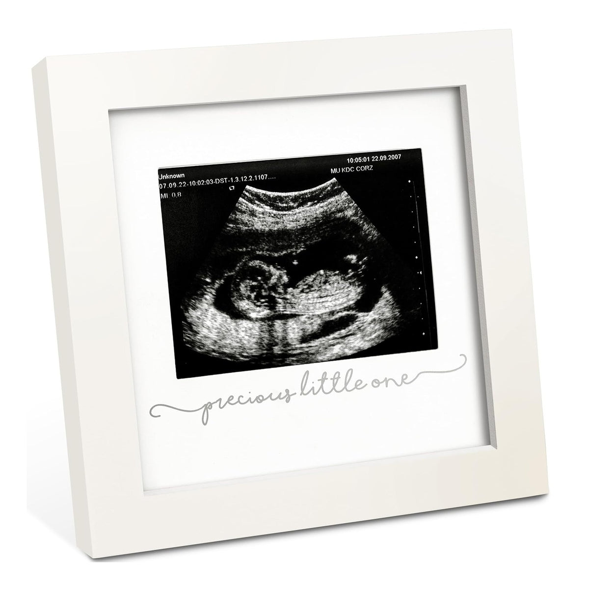 Baby Sonogram Picture Frame - Modern Ultrasound Picture Frames for Mom to Be, First Pregnancy Gifts for Expecting Mom & First Time Dad, Baby Gender Reveal Gifts