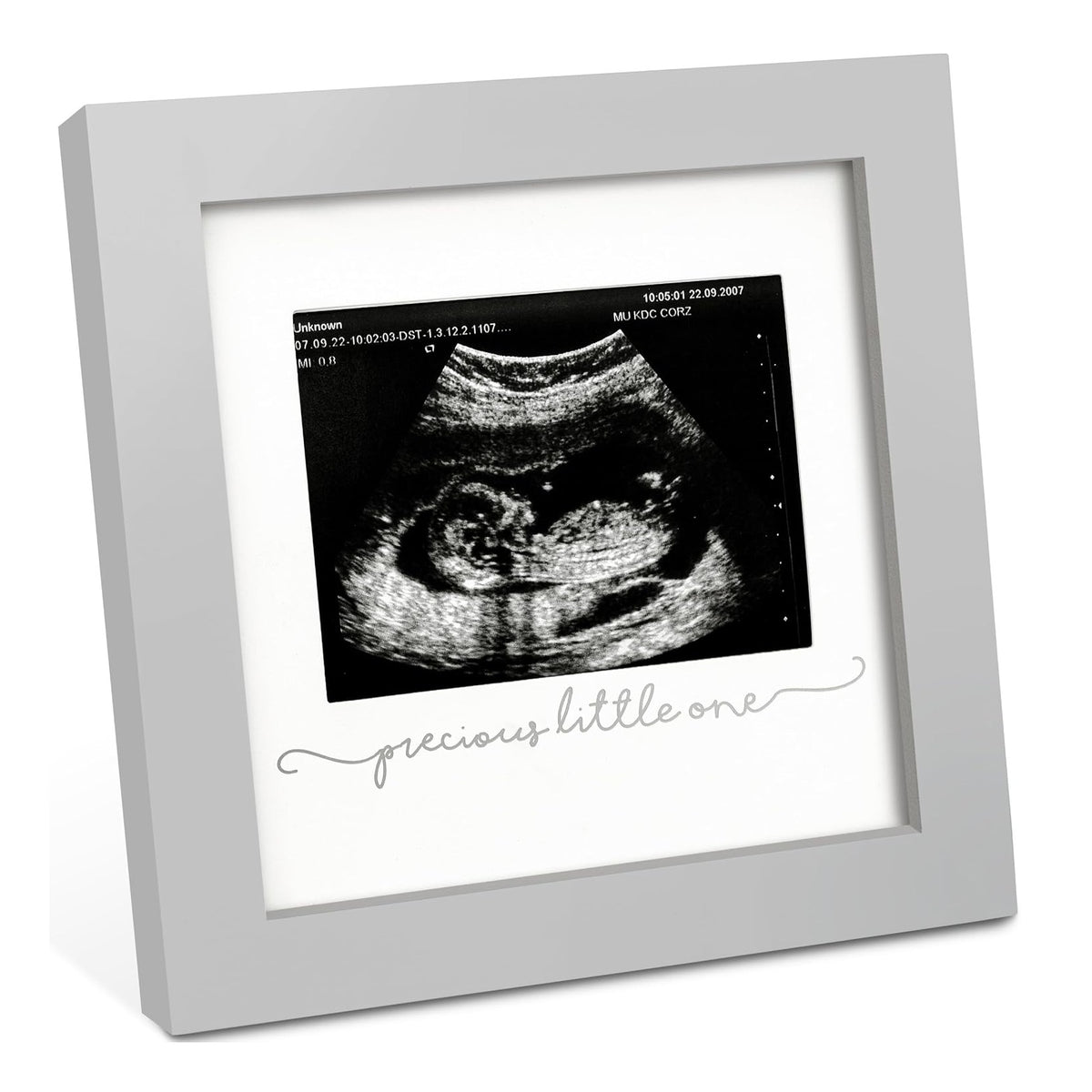 Baby Sonogram Picture Frame - Modern Ultrasound Picture Frames for Mom to Be, First Pregnancy Gifts for Expecting Mom & First Time Dad, Baby Gender Reveal Gifts