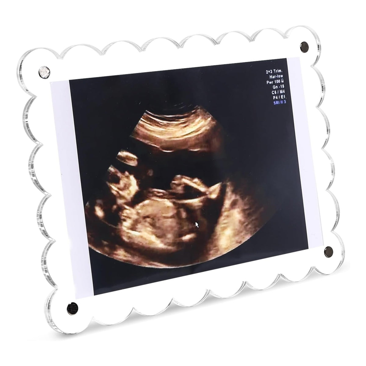 Magnetic Clear Acrylic Scalloped Baby Ultrasound Picture Frame - Sonogram Frame for Refrigerator, Display for Pregnancy Announcement, Gender Reveal & Expecting Parents Gifts(No Stand)