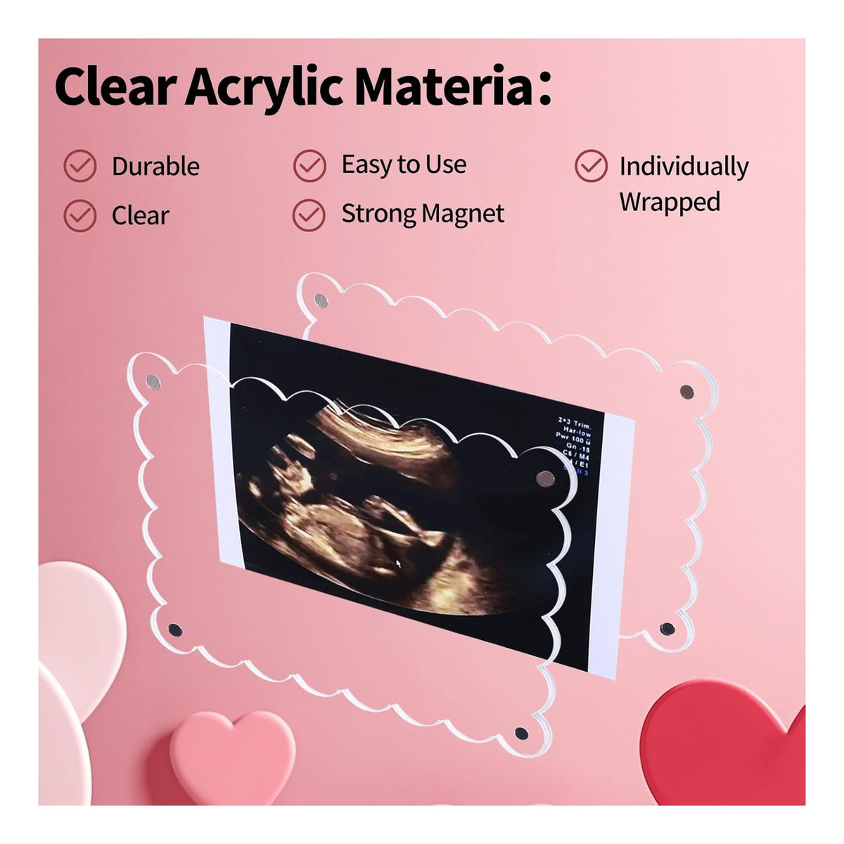 Magnetic Clear Acrylic Scalloped Baby Ultrasound Picture Frame - Sonogram Frame for Refrigerator, Display for Pregnancy Announcement, Gender Reveal & Expecting Parents Gifts(No Stand)
