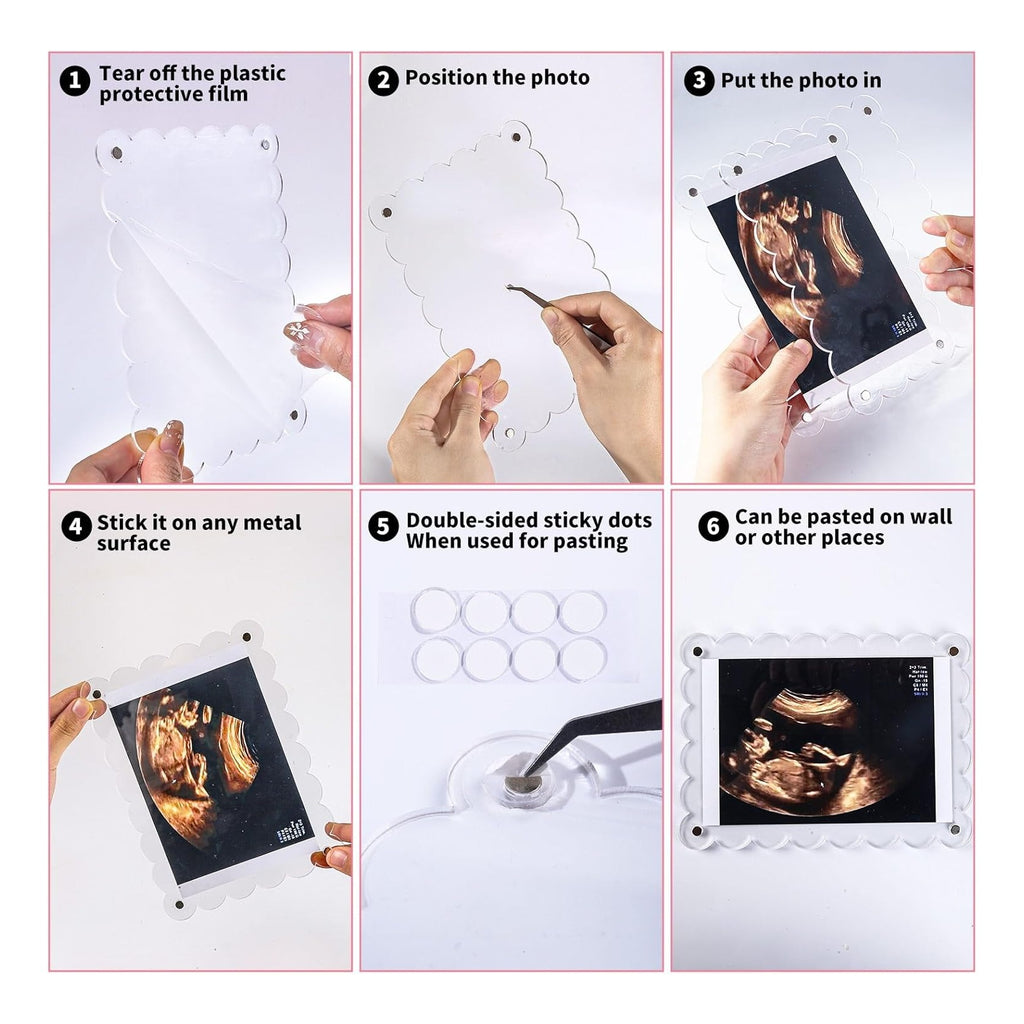 Magnetic Clear Acrylic Scalloped Baby Ultrasound Picture Frame - Sonogram Frame for Refrigerator, Display for Pregnancy Announcement, Gender Reveal & Expecting Parents Gifts(No Stand)