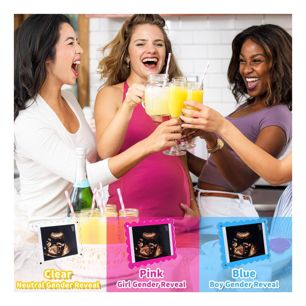Magnetic Clear Acrylic Scalloped Baby Ultrasound Picture Frame - Sonogram Frame for Refrigerator, Display for Pregnancy Announcement, Gender Reveal & Expecting Parents Gifts(No Stand)