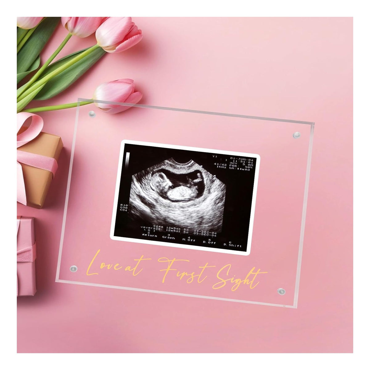 Ultrasound Picture Frame, Bright Photo Frame, Sonogram Love at First Sight Baby Keepsake Baby Announcement, Birth Information, Expecting Mom Parents to be Unique Gifts for Pregnant