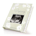 Pregnancy Journal, Pregnancy Announcements - 80 Pages Hard Cover Baby Books For Mom To Be Gift, Baby Memory Book Keepsake, Gender Reveal Gifts For New Moms, Shower & Registry